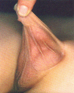 kısa penis