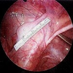 inmemis testis