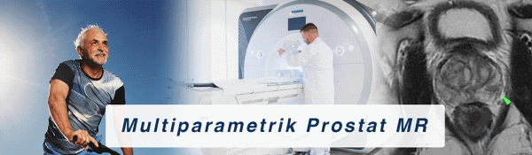 multiparametrik prostat mr